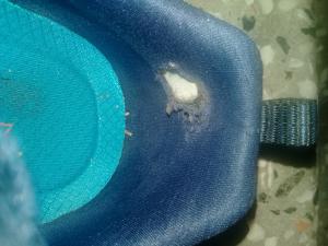 Skechers Yırtılan Ayakkabı