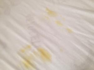 Prima Bebek Bezi Bantları Sorunlu Ve Taşma Yapıyor