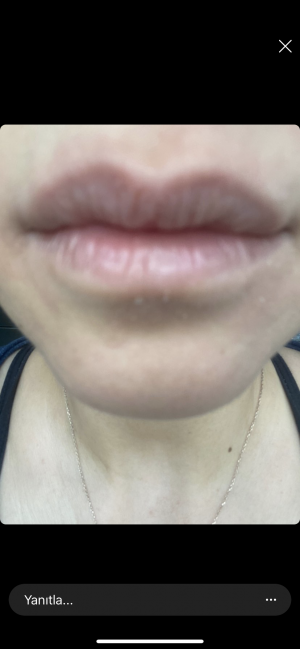 Misbahçe Ürünleri Yüzümü Mahvetti