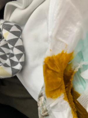 Molfix Bebek Bezi Sızdırıyor