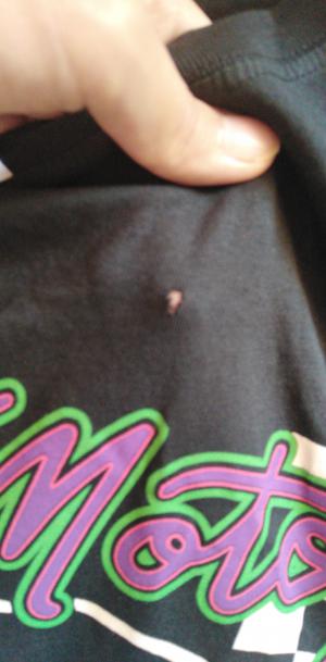 Trendyol Hasarlı Ürün Geldi