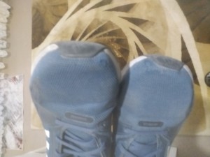 Adidas Ayakkabının Burun Kısmı Açıldı