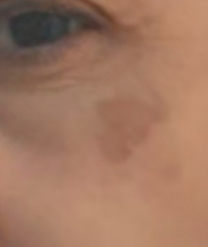 Güldeniz Odabaş Baby Go İşlemi Yüzü Mahvetti!!