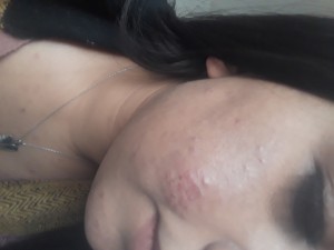 Lilium Güzellik Merkezi Gaziantep Bb Glow Ve Cilt Bakımı Yaptırdım Ama Hiçbir Faydasını Görmedim