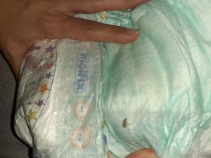 Molfix Bez İçinde Ölü Böcek Çıkması