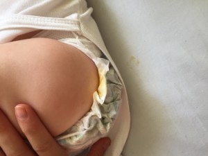 Molfix Bez Kakasını Çıkarıyor