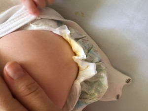 Molfix Bez Kakasını Çıkarıyor