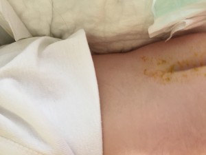 Molfix Bez Kakasını Çıkarıyor