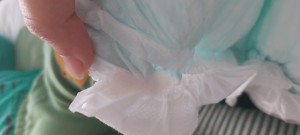 Molfix Bez Sıkıntısı 200 Tl Verip Beze Sıkıntı Yaşamak