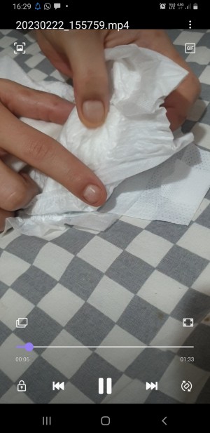 Molfix Bezin İçinde Resmen Taş Var