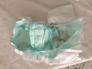 Molfix Bezin Yarısının Olmaması