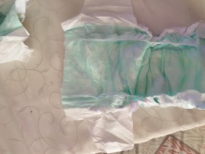 Molfix Bezin Yarısının Olmaması