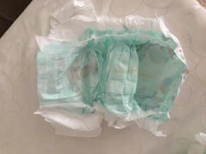 Molfix Bezin Yarısının Olmaması