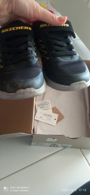 Skechers Bir Saat Giyilen Ayakkabı Deforme Oldu