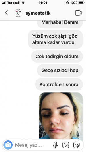 Sym Medikal Estetik Danışmanlık Botox Dolgu