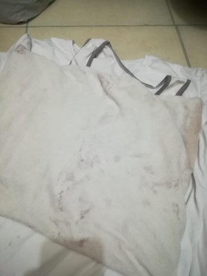 Profilo Çamaşır Makinam Yıkamıyor