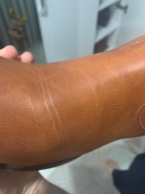 Trendyol Defolu Ürün