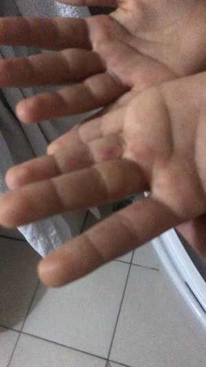 Media Markt Dezenfektan Kullanımı Yeğenimin Elini Yaktı