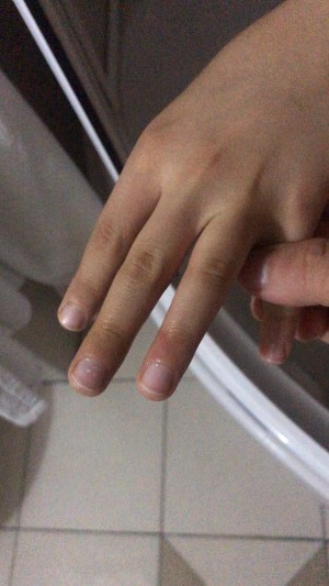 Media Markt Dezenfektan Kullanımı Yeğenimin Elini Yaktı