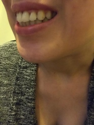 Avrupa Diş ''Eğer Şikayetinizi Kaldırmazsanız Size Dava Açarız'' Yetkili Kişi Tarafından Tehdit Edildim