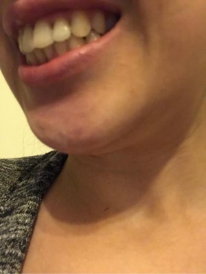 Avrupa Diş ''Eğer Şikayetinizi Kaldırmazsanız Size Dava Açarız'' Yetkili Kişi Tarafından Tehdit Edildim