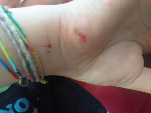 Şok Market Kaygan Zemin Nedeniyle Çocuğum Düştü