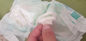 Molfix Kireç Tabakası Sert Çıkıyor Paketlerin İçinden 1 Pakette En Az 15 Tanesi Bu Şekilde Çıkıyor