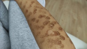 Dudullu Estecool Şikayet