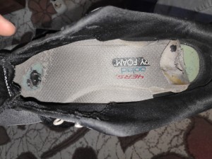 Skechers Taban Parçalanması