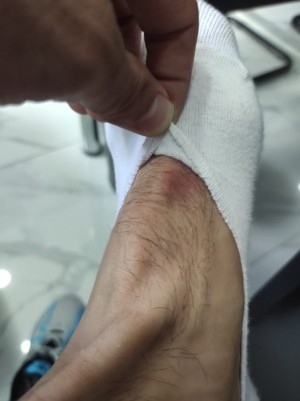 Adidas Ürün Hatası