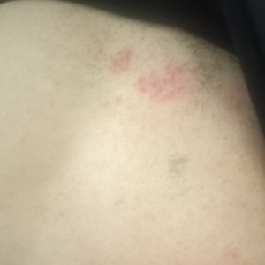 Agiss Üründen Şikayetçiyim