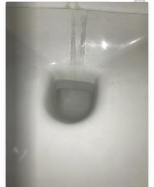 Vitra Klozet Siyah Leke Sorunu