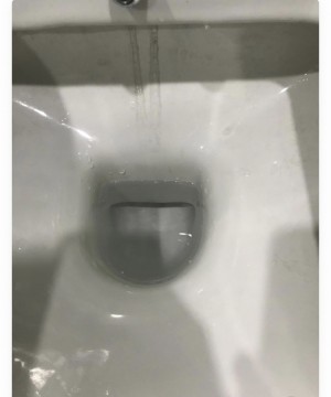 Vitra Klozet Siyah Leke Sorunu