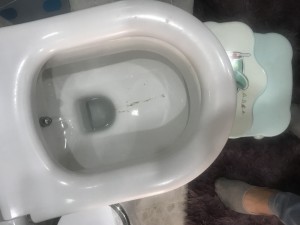 Vitra Klozet Siyah Leke Sorunu