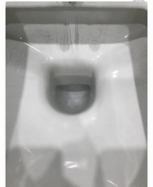 Vitra Klozet Siyah Leke Sorunu