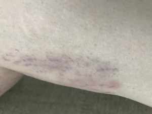 Sevgi Medlife Yanlış İşlem