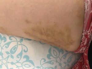 Sevgi Medlife Yanlış İşlem