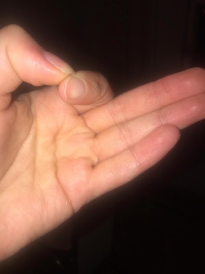 A101 Market Birşah Yoğurt Yoğurttan Kıl Çıktı