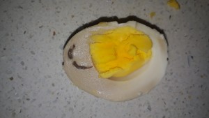 A101 Market Yumurtadan Yabancı Cisim