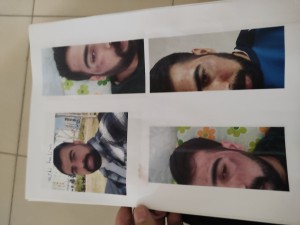 Lilium Güzellik Merkezi Yüzüm Lazer Epilasyon Yaparken Yaktı Beni