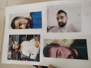 Lilium Güzellik Merkezi Yüzüm Lazer Epilasyon Yaparken Yaktı Beni